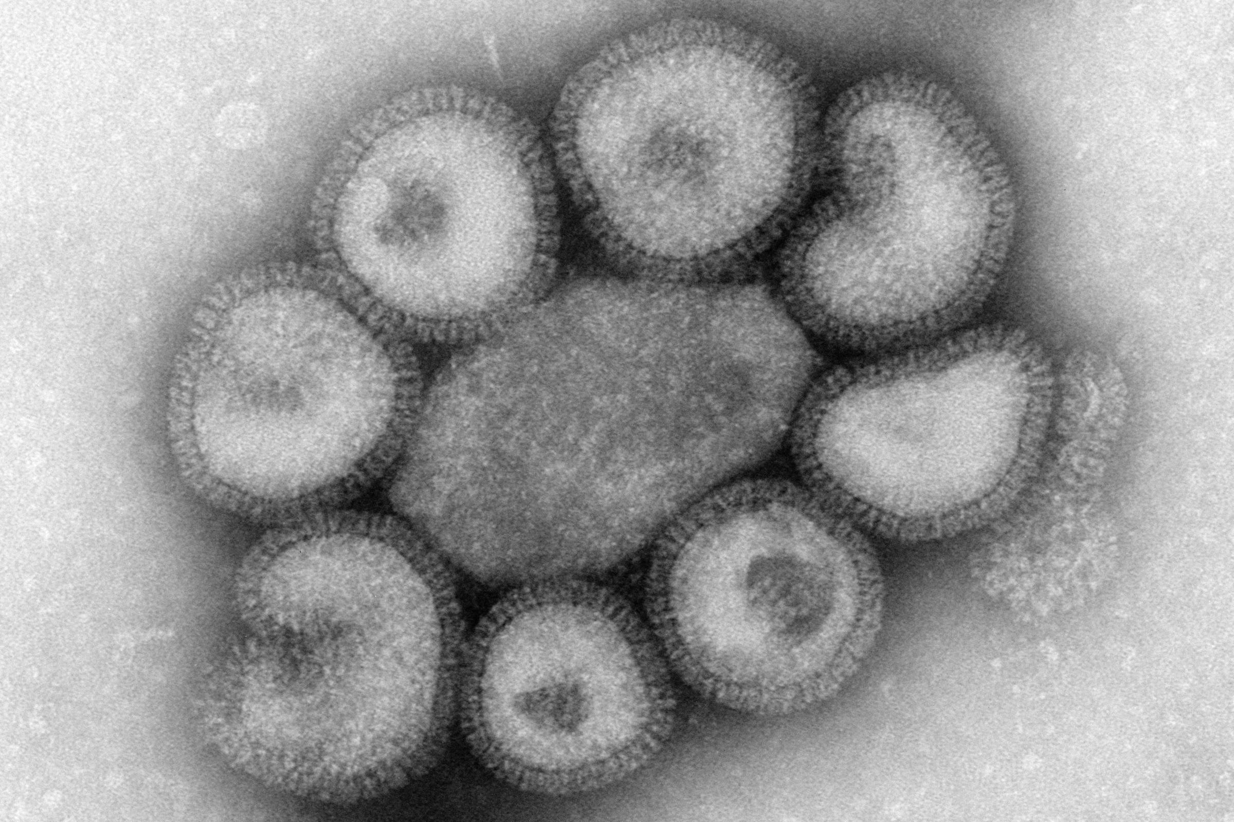 In southern Maine Child deaths from influenza related sickness : CDC
